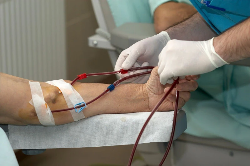 اکسس همودیالیز