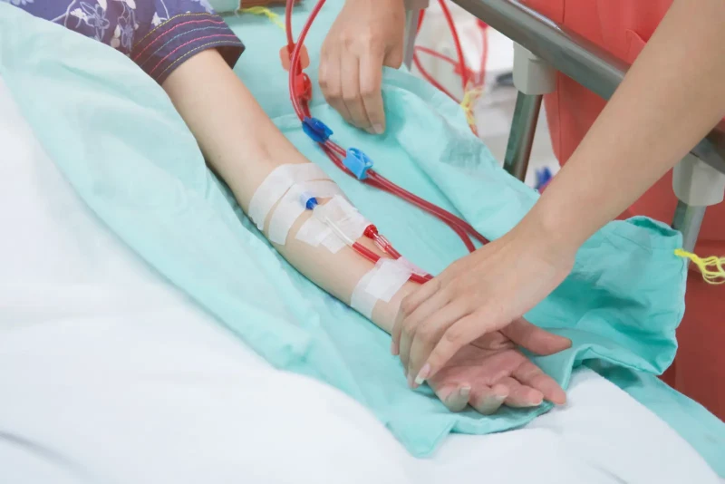اکسس همودیالیز چیست